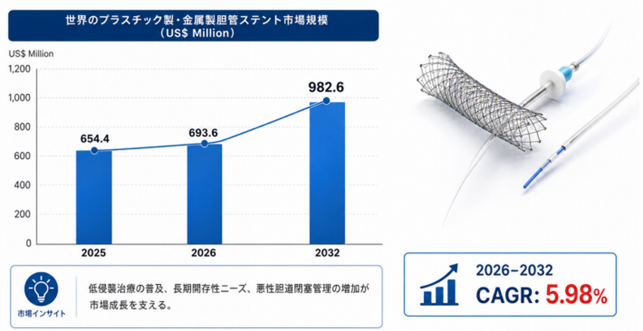 プラスチック製および金属製胆管ステント市場分析情報2026：733百万米ドル規模と年平均成長率5.6%を予測